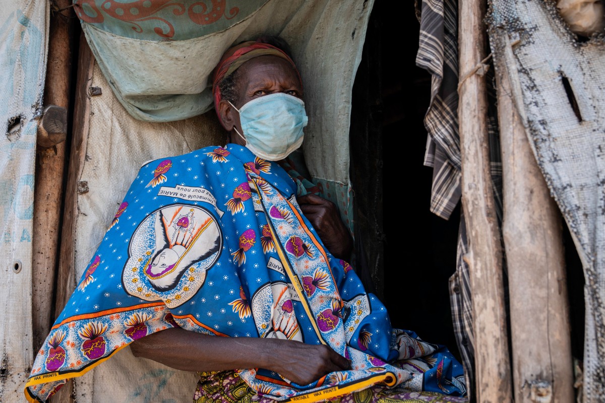 A displaced woman wears a mask as she sits outside her shelter in the Kigonze camp in Bunia, in the eastern Democratic Republic of the Congo, on May 28, 2026.
