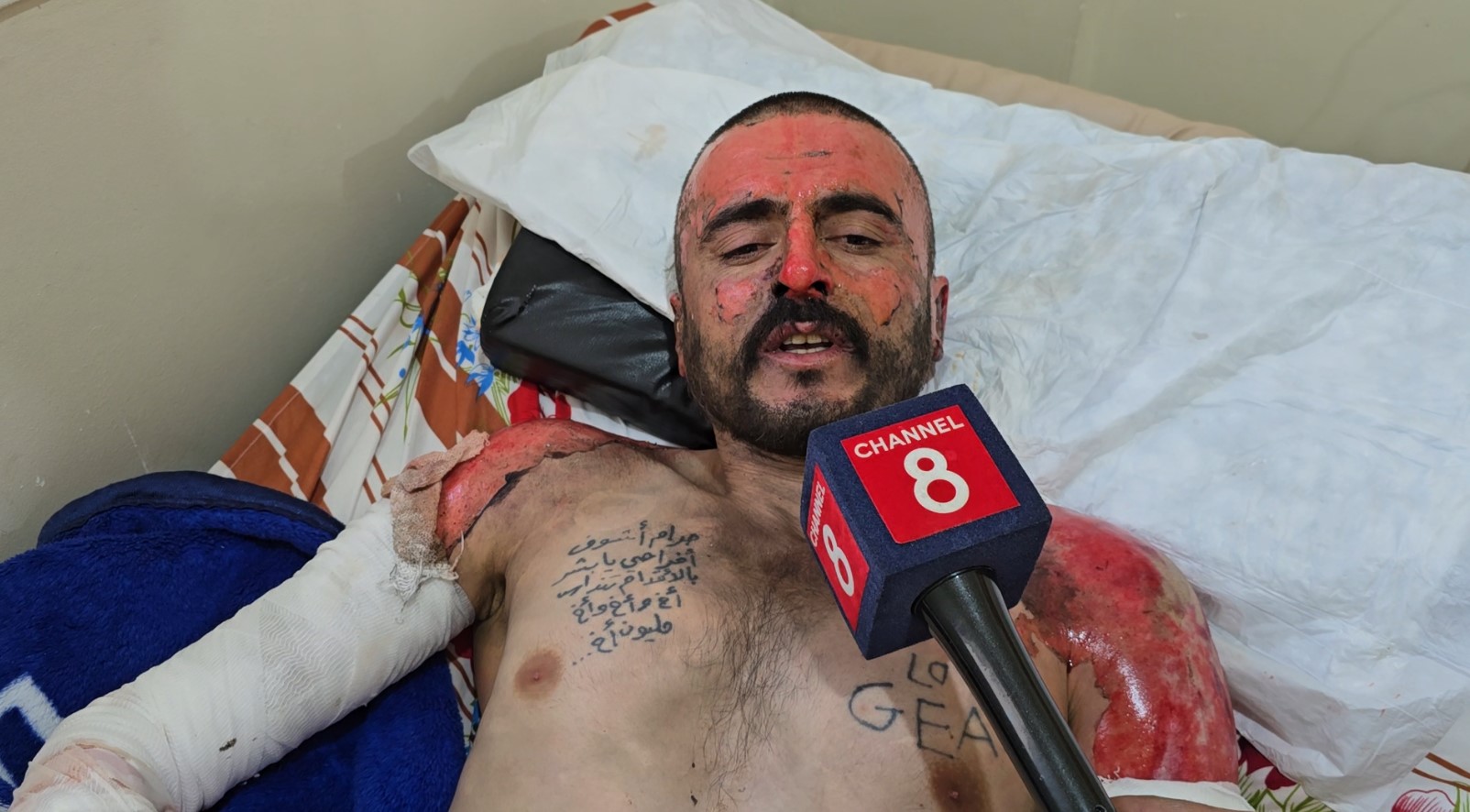 One of the injured in the Kobani prison fire speaks to Channel 8 on September 12, 2026. Photo: Channel8 

