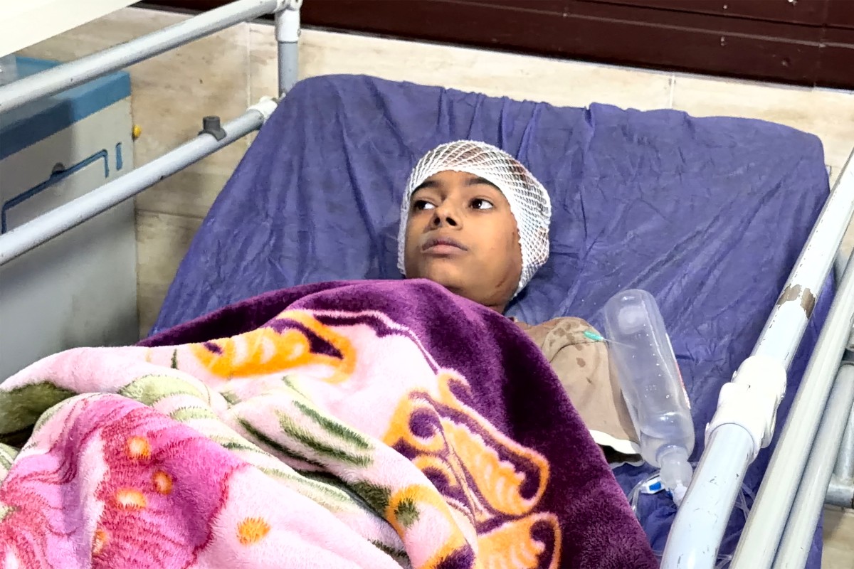 A child lies on a hospital bed receiving treatment following injuries from an overnight strike in Kuhestak, Sirik County, in Iran's southern Hormozgan province on September 2, 2026.