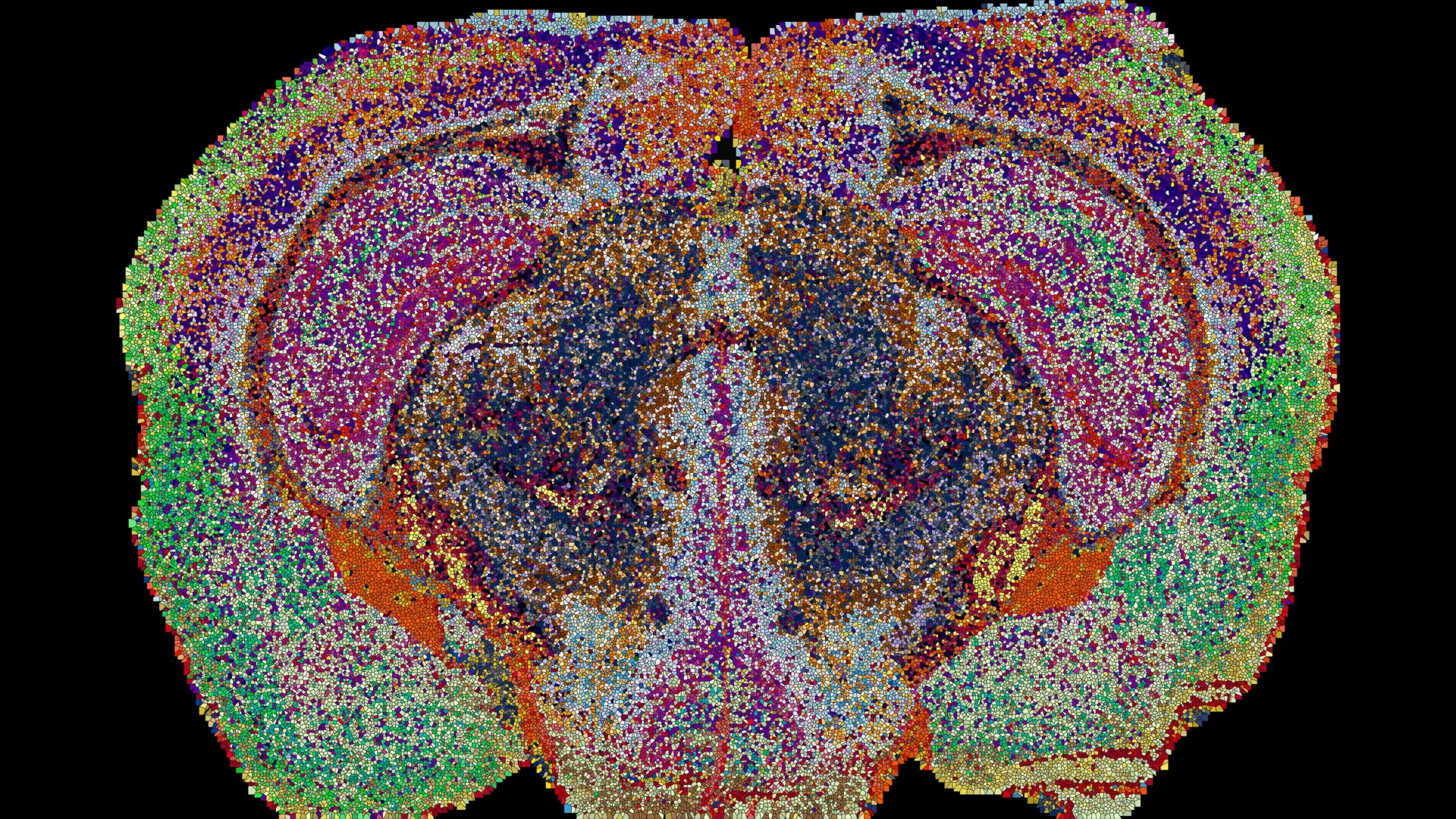 Lipizones in the mouse brain, determined by MALDI-MSI. Dots are enlarged for visualization purposes. Credit: 2026 EPFL/Luca Fusar Bassini, CC-BY-SA 4.0
