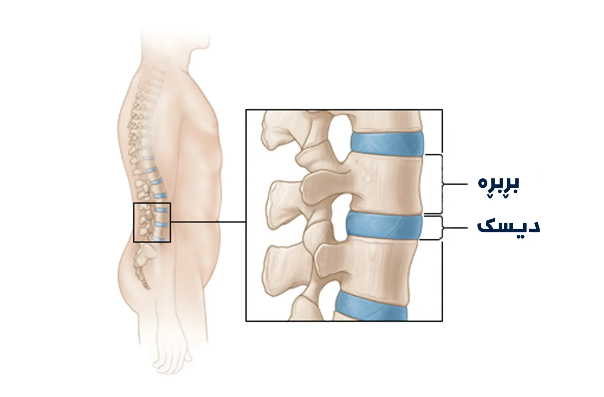دیسکەکان جومگەی نێوان بڕبڕەکانن
