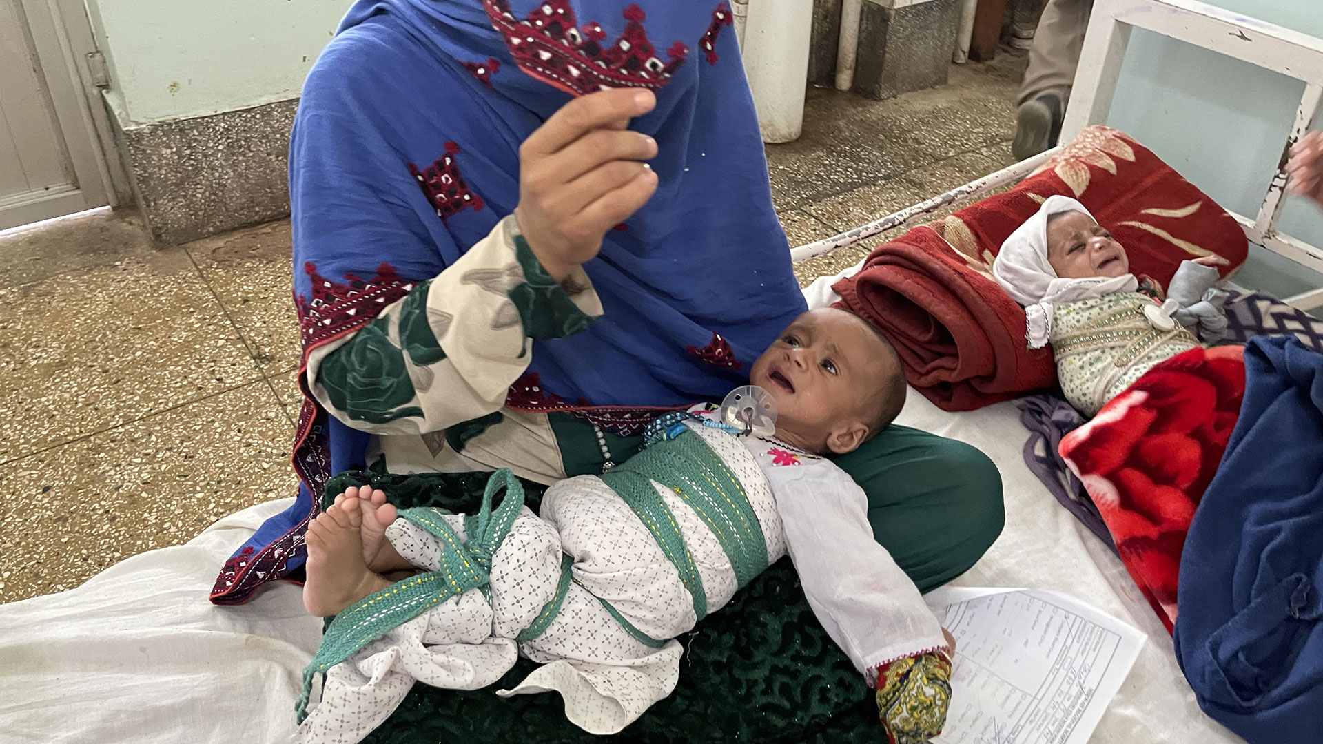 منداڵێکی بەدخۆراک لە یەکێک لە نەخۆشخانەکانی ئەفغانستان لە باوەشی دایکدایە بۆ وەرگرتنی چارەسەر