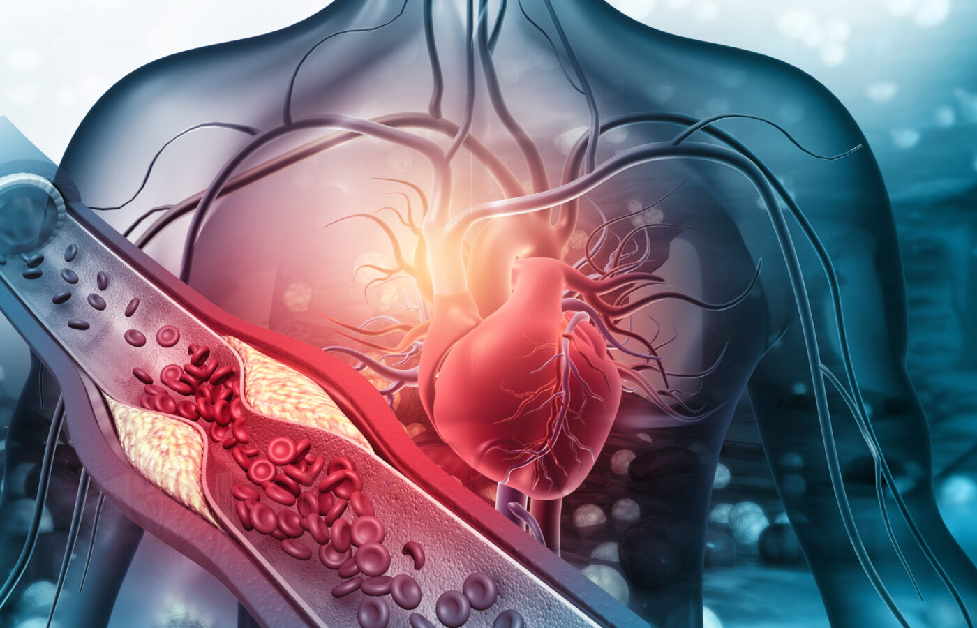 ڕێژەی تووشبوون بە نەخۆشییەکانی دڵ زیادی کردووە 